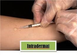 intradermal